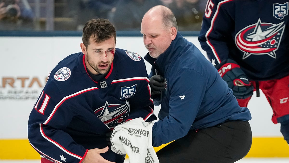 Columbus Blue Jackets' Miles Wood to miss time with 'scary' injury