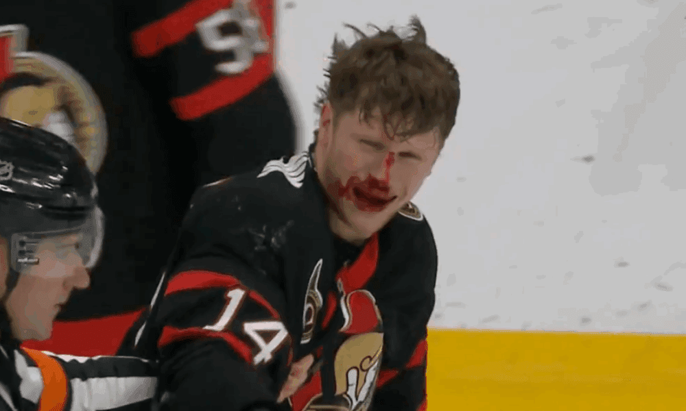 montreal canadiens ottawa senators blood