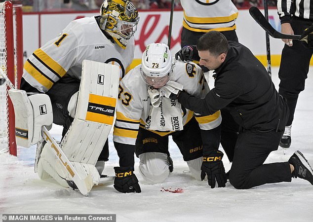 Boston Bruins star Charlie McAvoy was struck in the face by a puck on Saturday night