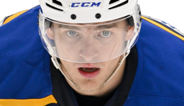 Blues' Alexey Toropchenko burned on legs in home accident