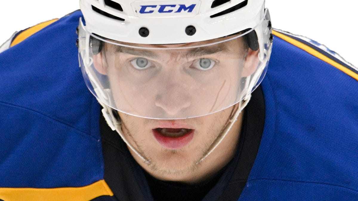 Blues' Alexey Toropchenko burned on legs in home accident