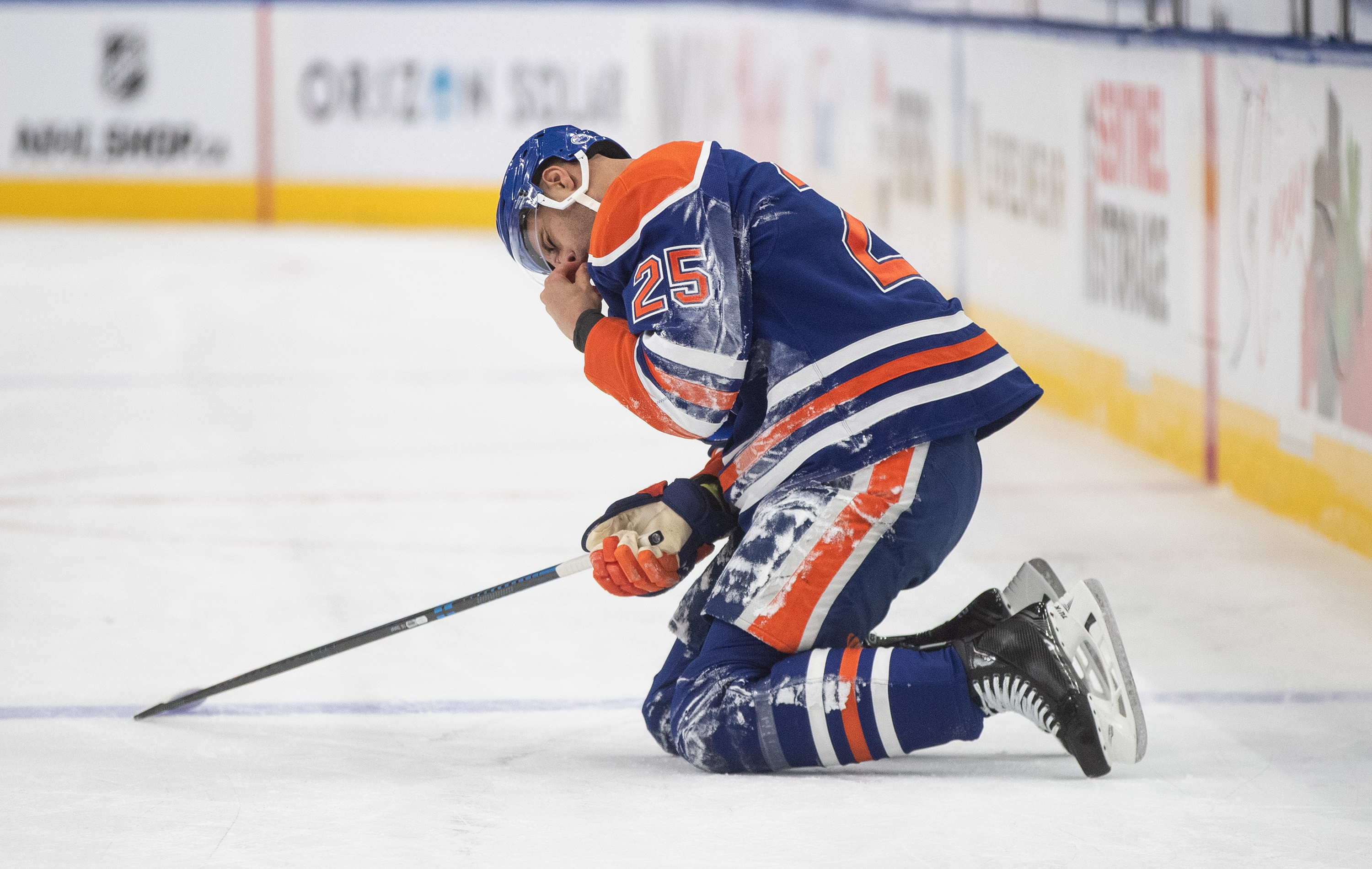 The Edmonton Oilers’ Darnell Nurse holds his mouth after taking...