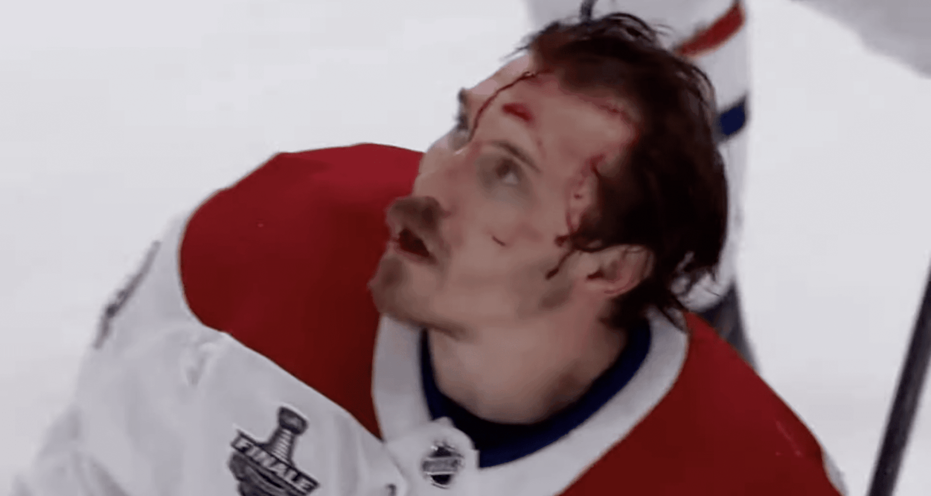 Drouin Out Indefinitely; Gallagher At Least A Week