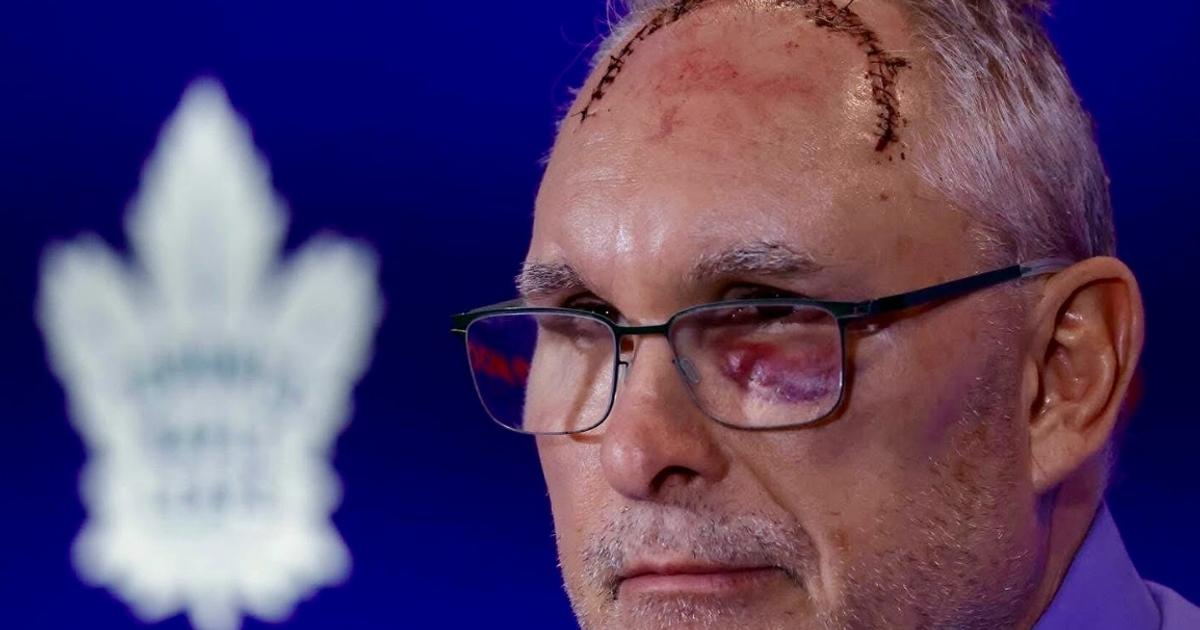 We finally know all the details behind Craig Berube’s freak gym incident