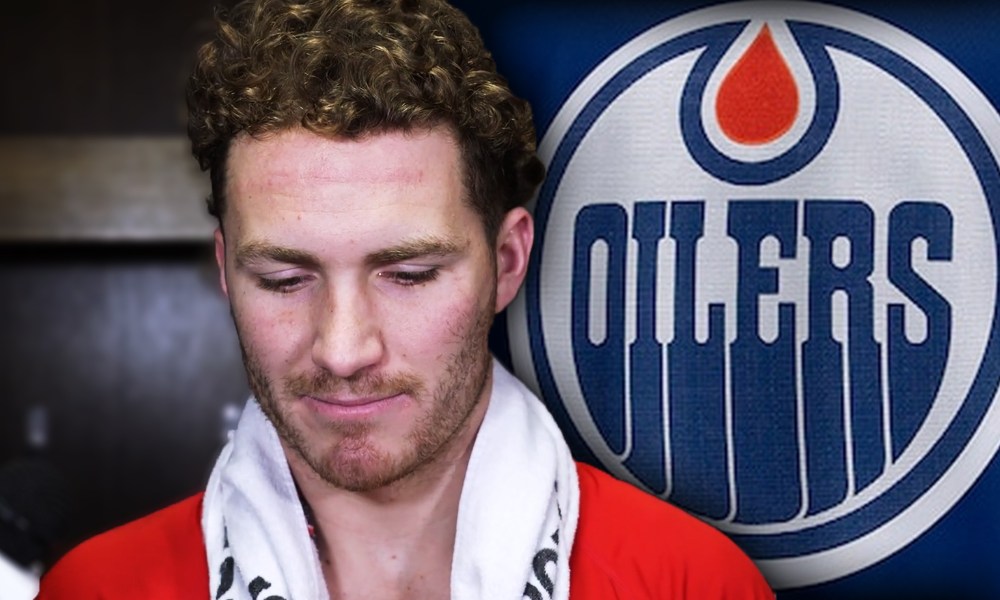 Oilers Analyst Calls for Major Response to Matthew Tkachuk in Next Matchup