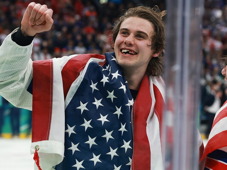 jack hughes teeth getty 2