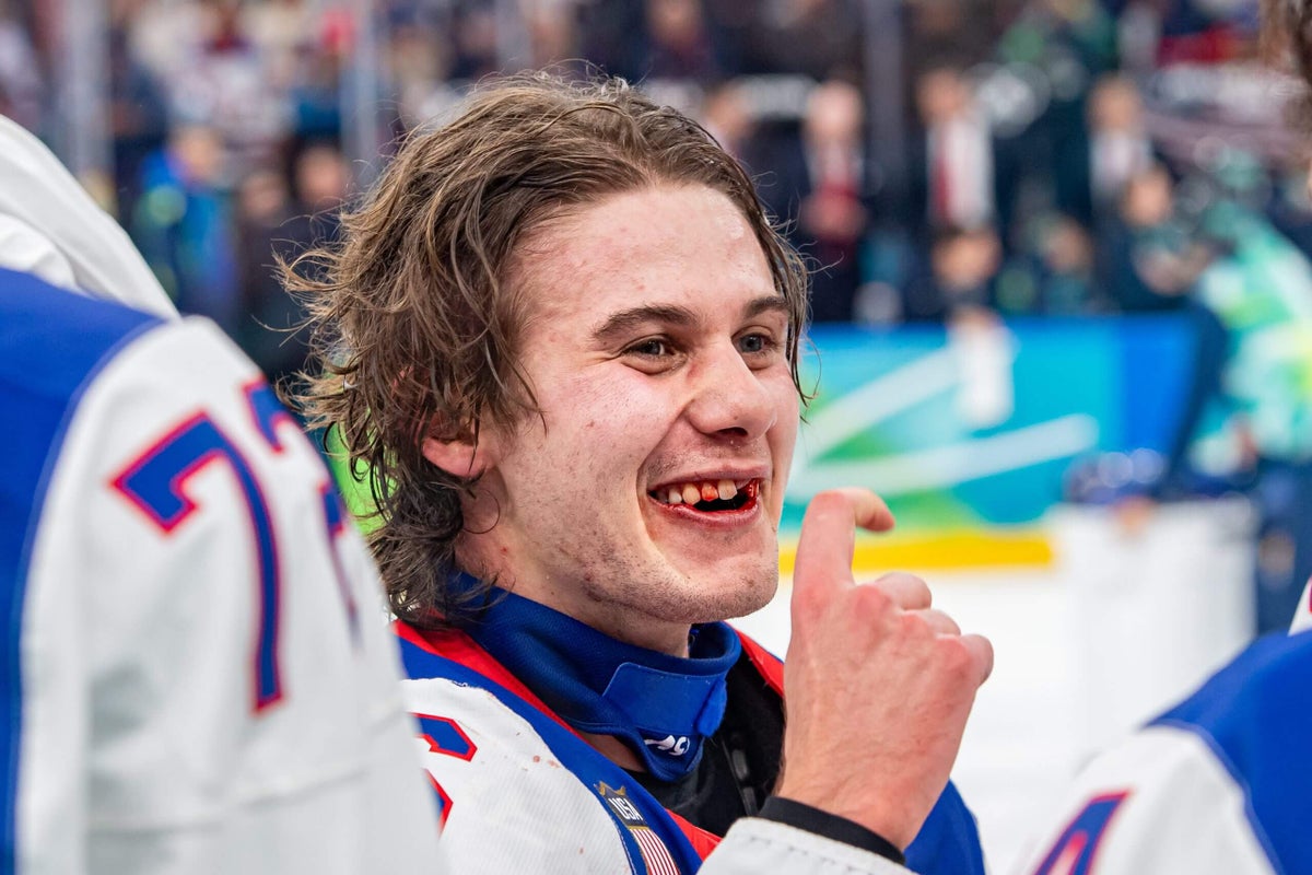 Jack Hughes scores golden goal with shattered smile: ‘I looked on the ice and saw my teeth’