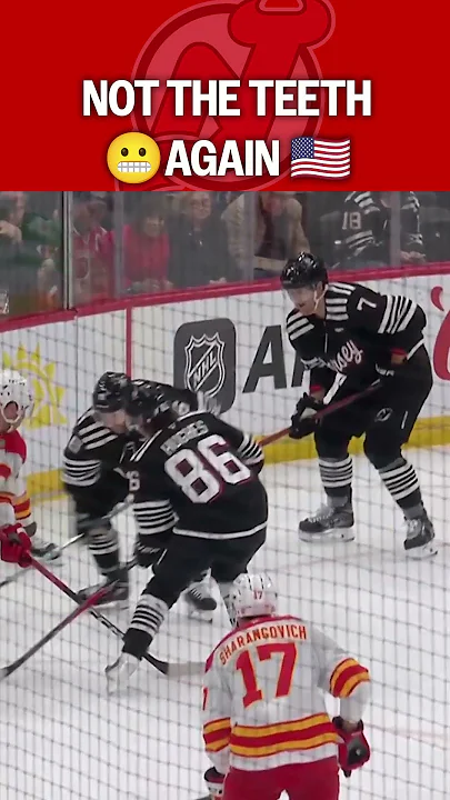 Olympic Teeth Flashbacks for Hughes 😬 - YouTube