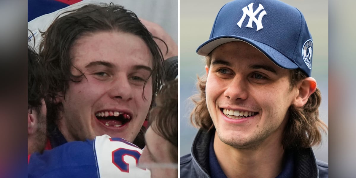 Olympic hero Jack Hughes sports new teeth after taking hockey stick to mouth in gold medal final