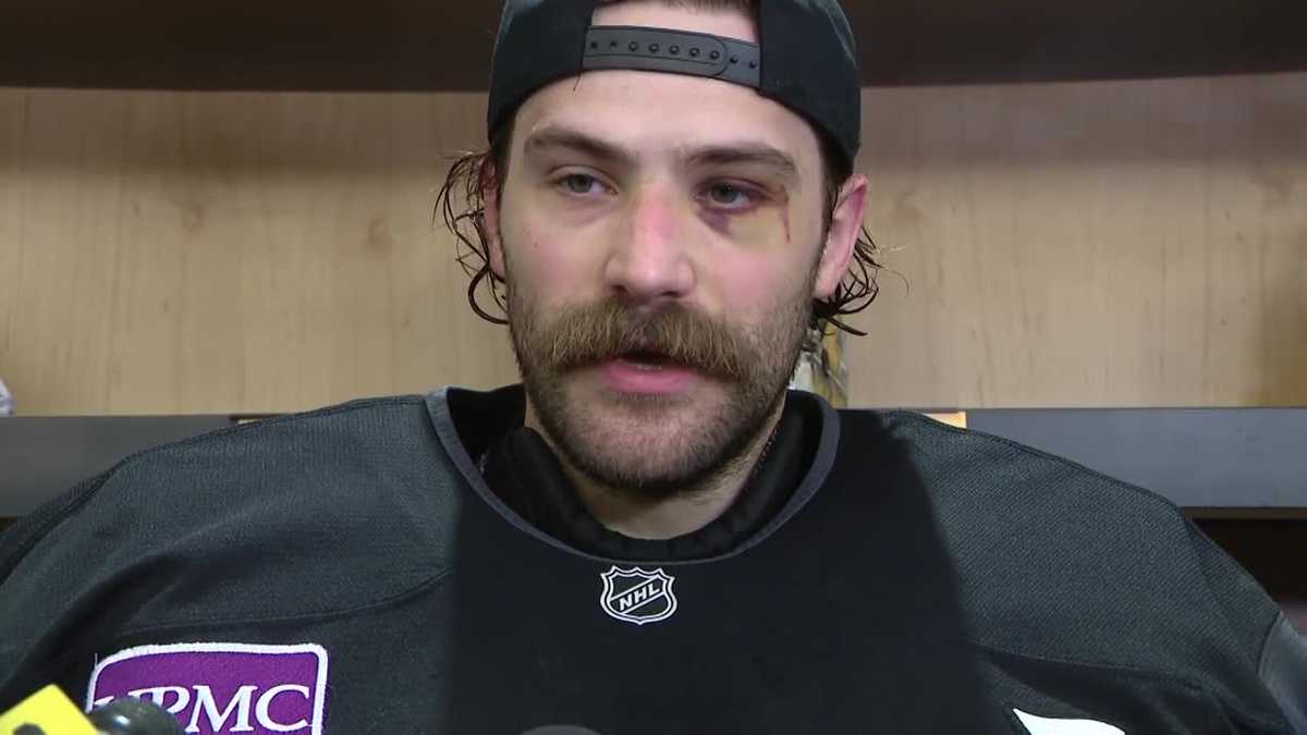 Penguins goaltender Stuart Skinner hit by puck near eye