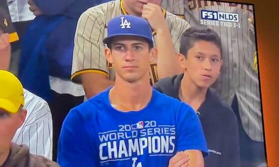 MFW the Dodgers offense completely disappears this series (no literally that’s my face)