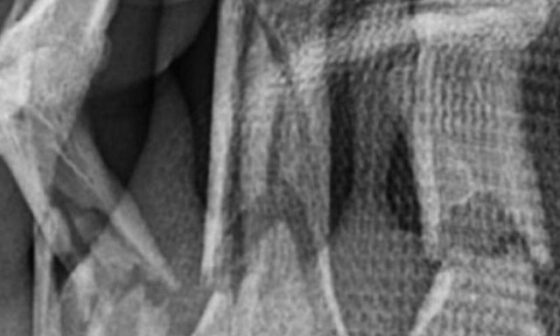 X-ray of Xavier McKinney hand injury