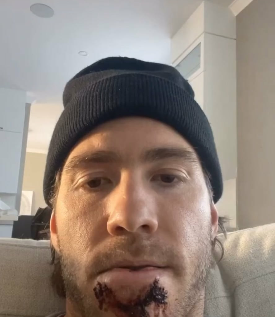 Mike Hoffman via Instagram Stories