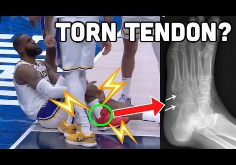 UCLA Doctor Explains how LeBron Played with a TORN Foot Tendon