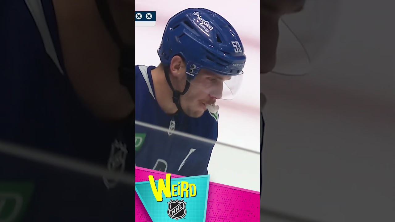 BOtched! 🫢 | Weird NHL #shorts
