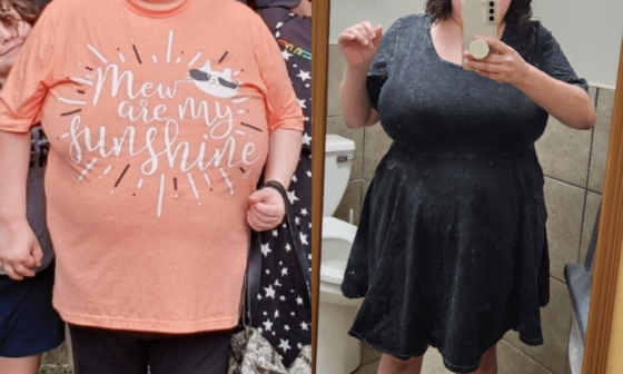 F/31/5'1[260>209=51lbs lost] This is hard t