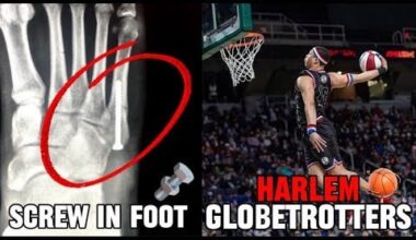 Any Hooper Break their Foot⁉️