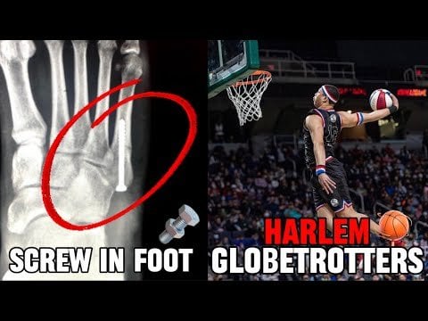 Any Hooper Break their Foot⁉️