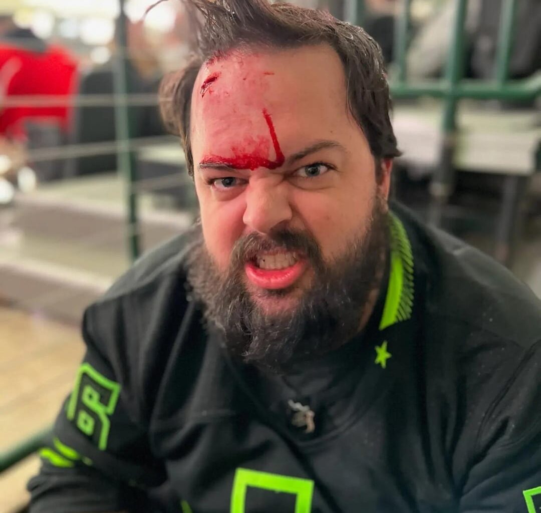 Got hit with a puck, does anyone have the clip?