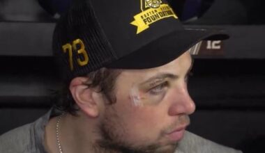 Charlie McAvoy’s face has taken quite the beating these playoffs.