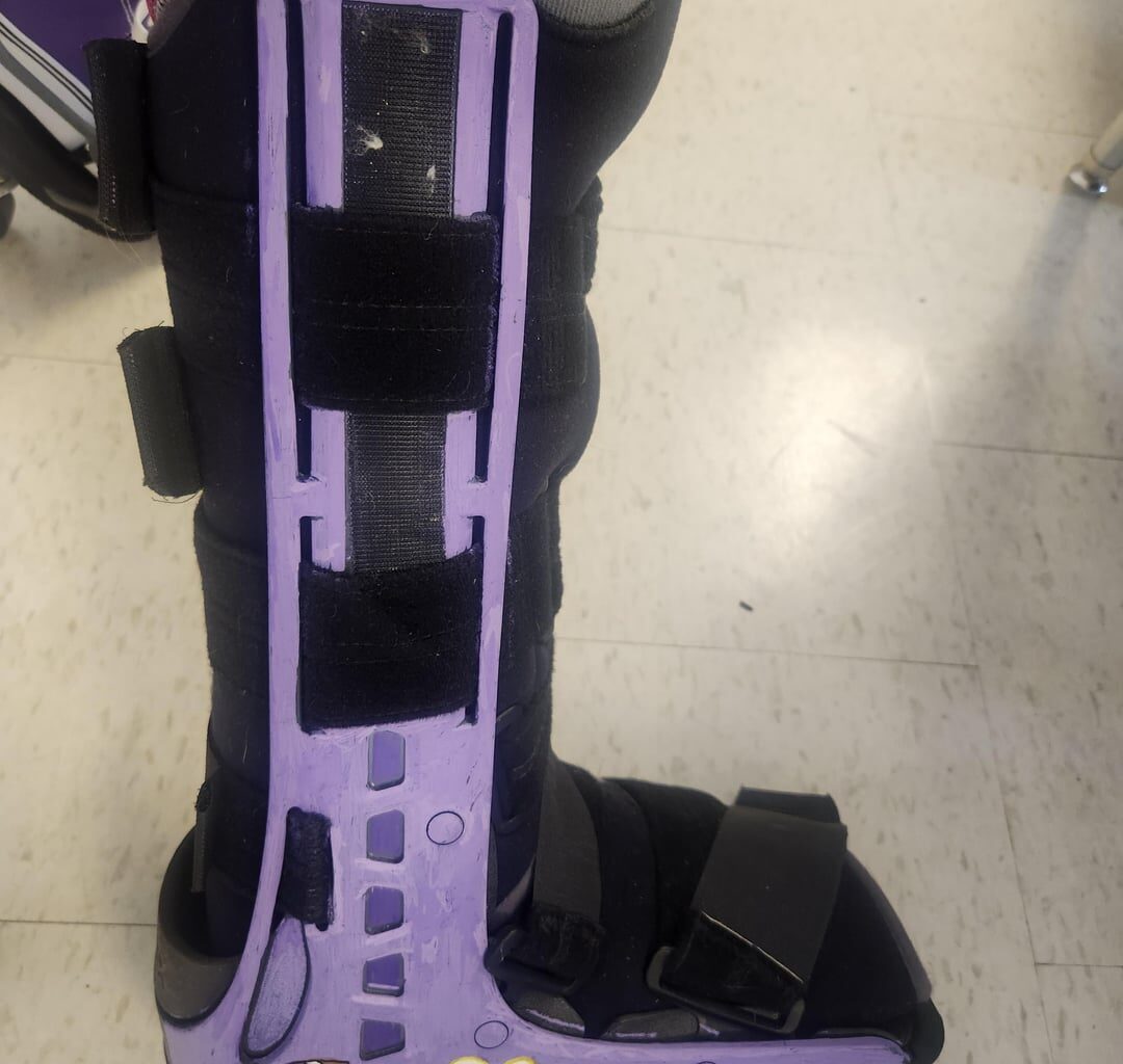 What to do when you break your leg and get stuck in a boot