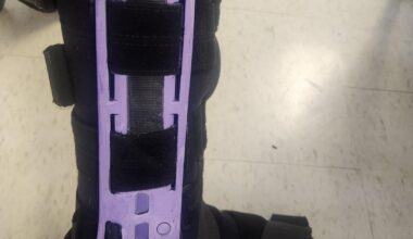 What to do when you break your leg and get stuck in a boot