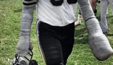 Conrad Dobler- I hope the refs checked that wrap to make sure he didn’t hide a brick in there