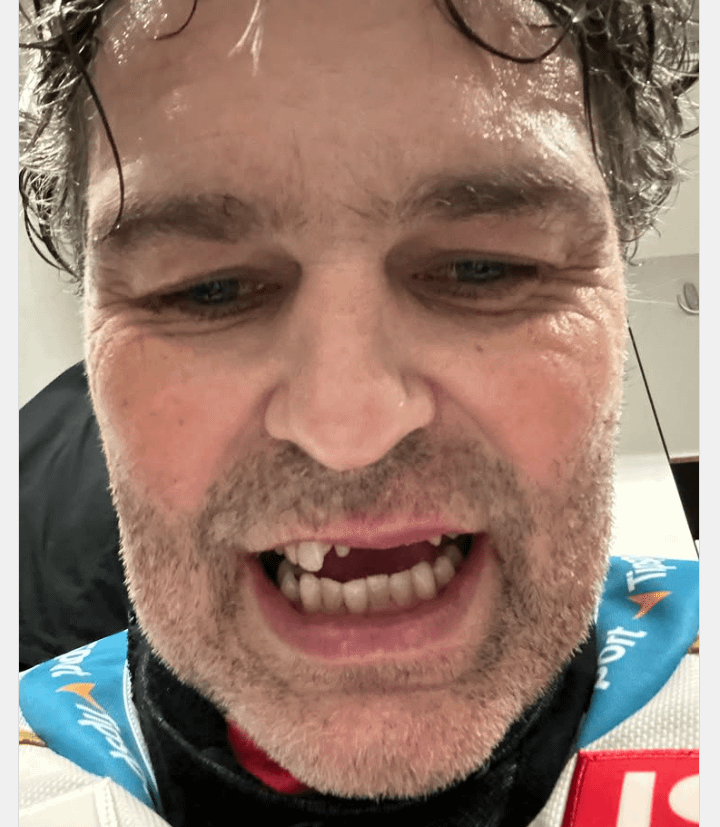 Jagr loosing whole lotta of teeth yesterday