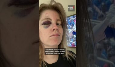 Toronto Blue Jays fan hit in face by 110mph foul ball ⚾🧢 #TO #baseball #BoBichette