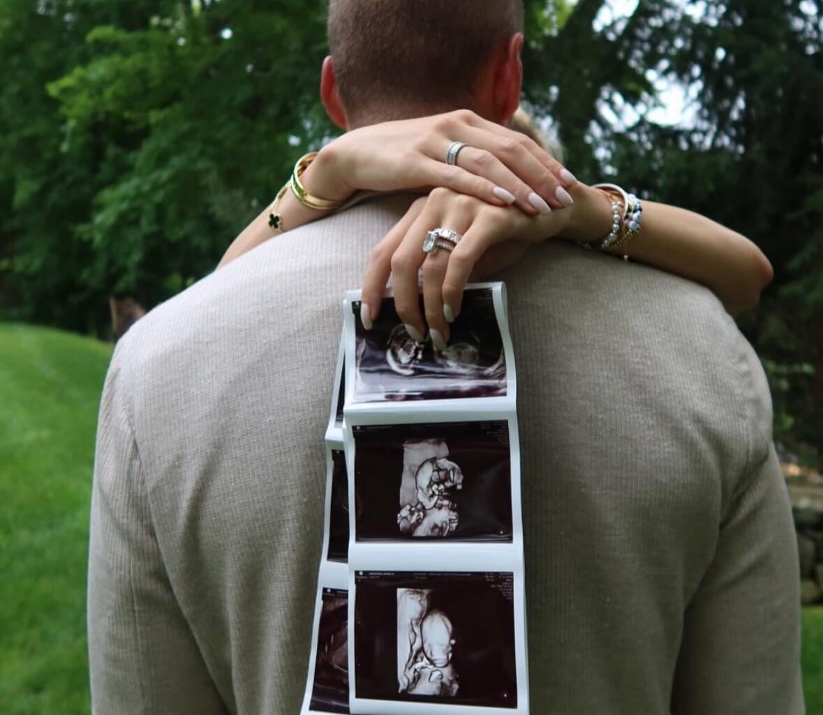 Pulock dad powers coming soon