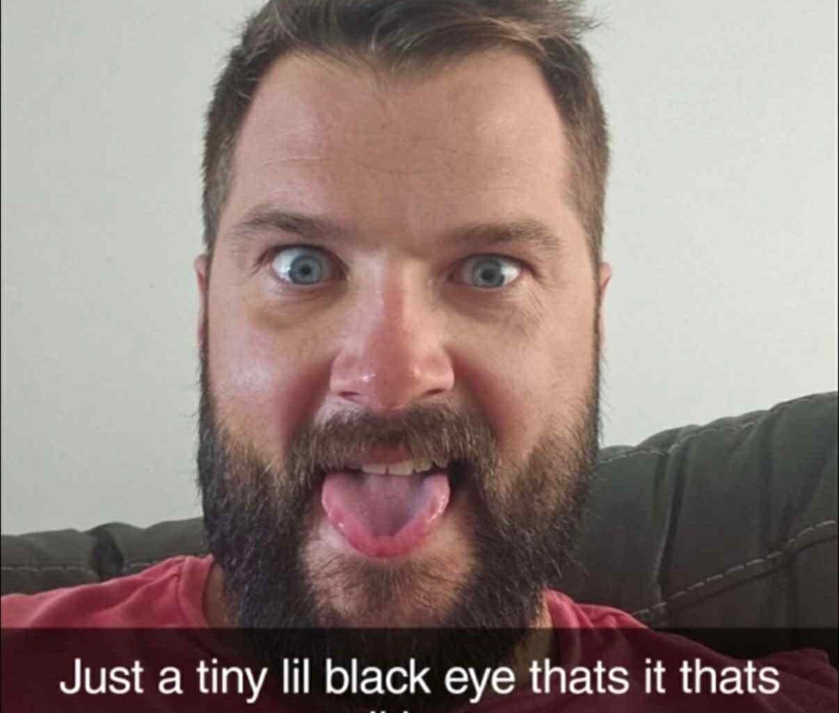 Post fight pic.... he's proud of himself.....  if you saw the golf course fight