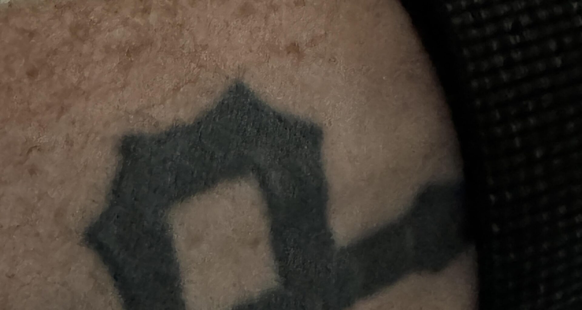 Any Tattoo Coverup Ideas?