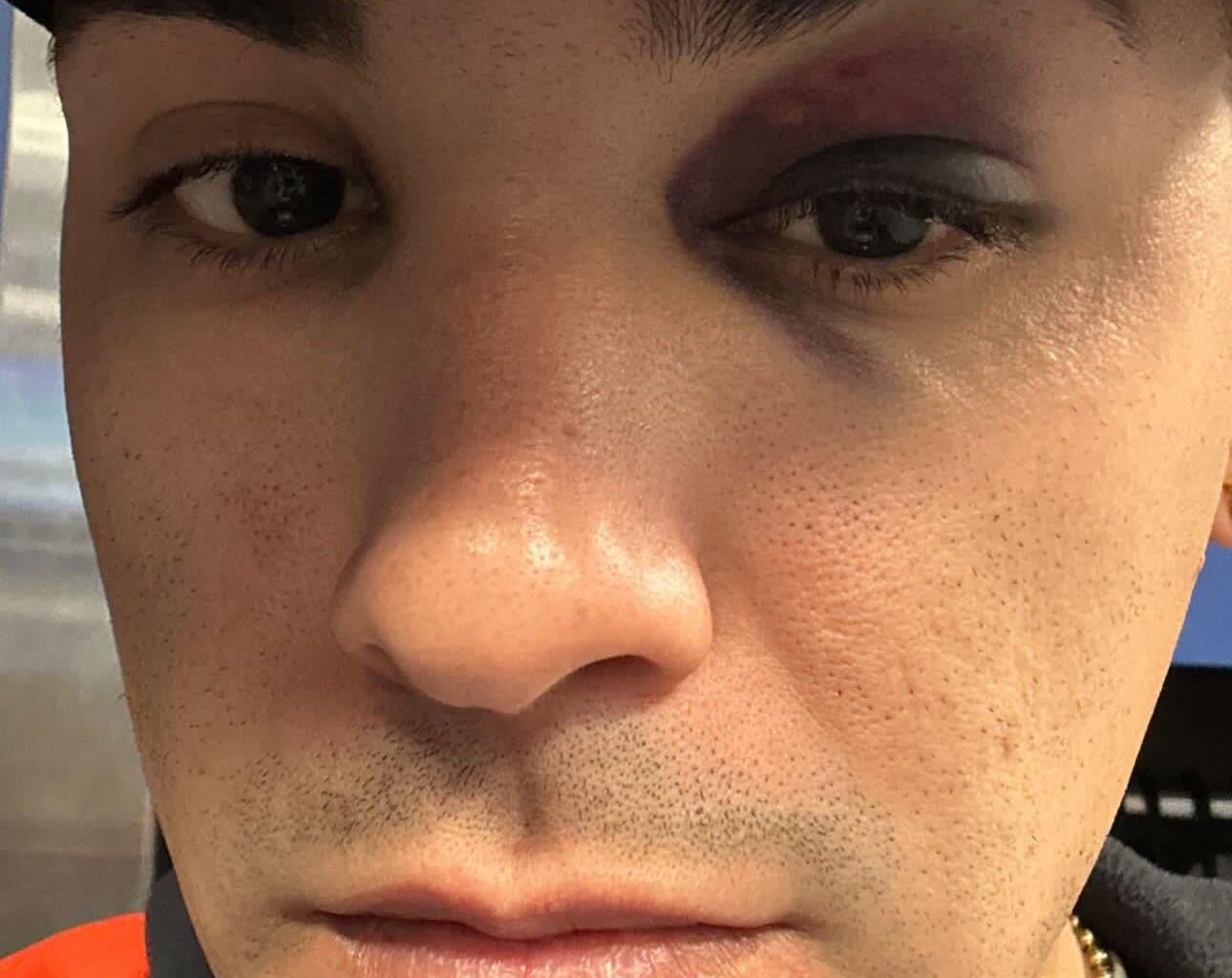 Javy posted an update