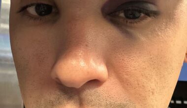 Javy posted an update