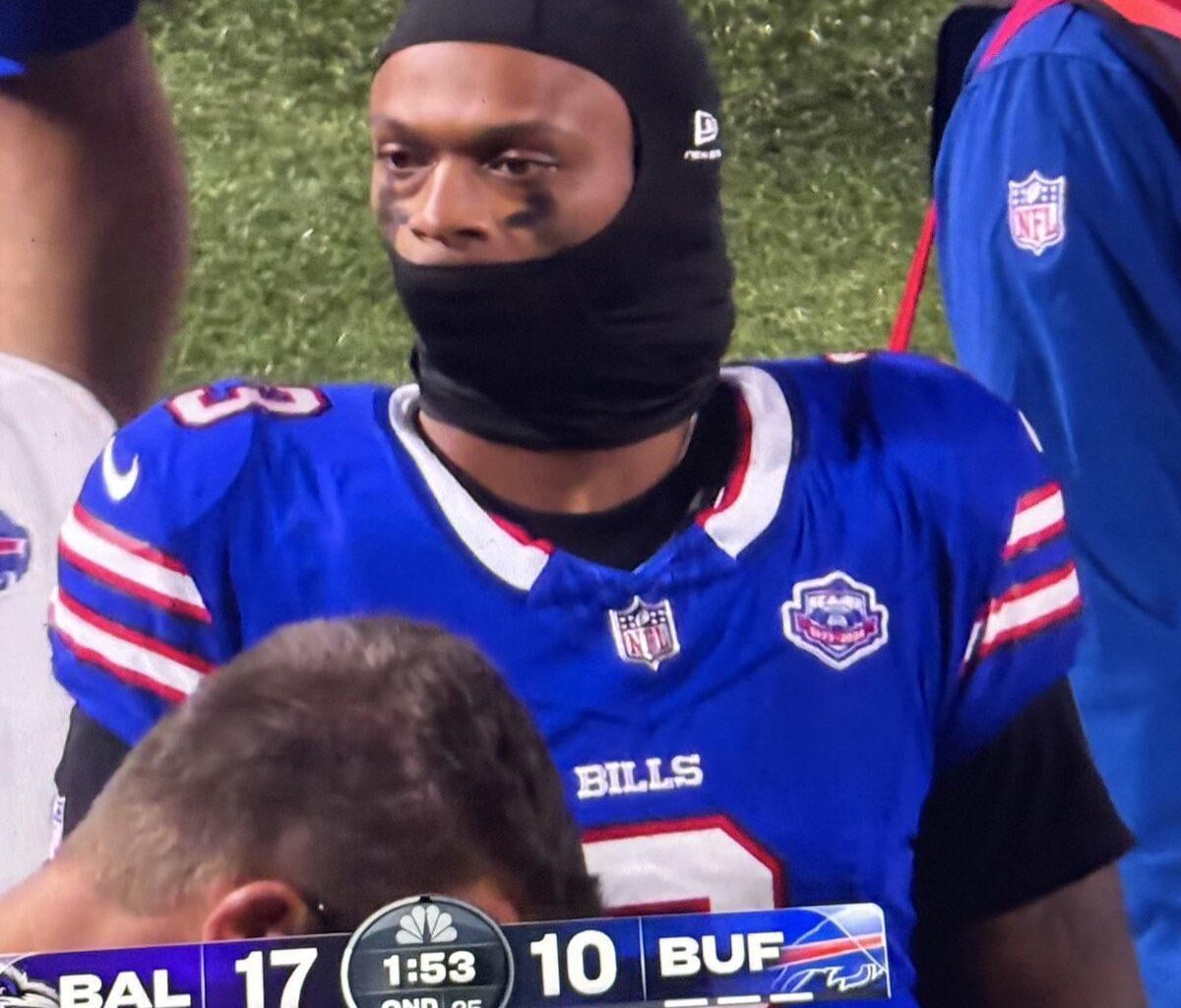 Why he look like Lord Voldemort