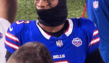 Why he look like Lord Voldemort