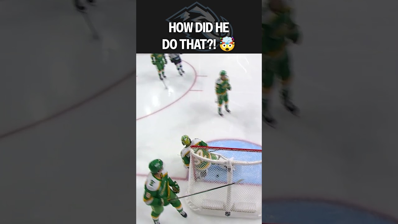 INSANE HAND-EYE 🤯