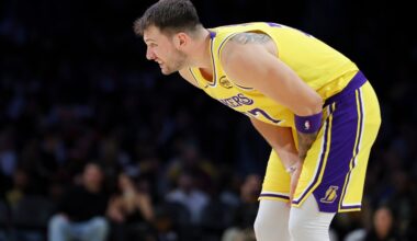 Lakers’ Luka Doncic likely out at least one week with a sprained finger and a bruised leg