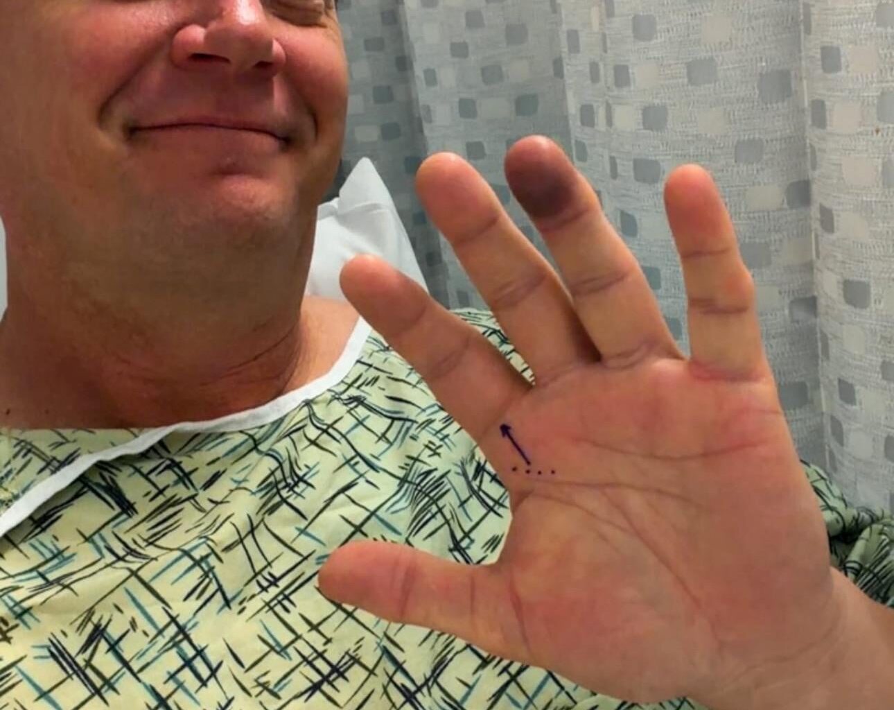 Not even our announcers are safe..