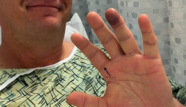 Not even our announcers are safe..