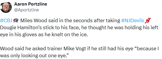 [Portzline] Miles Wood said in the seconds after taking Dougie Hamilton’s stick to his face, he thought he was holding his left eye in his gloves as he knelt on the ice. Wood said he asked trainer Mike Vogt if he still had his eye “because I was only looking out one eye.”