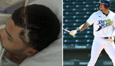 Rays prospect Isaac reveals 'life-saving' brain surgery