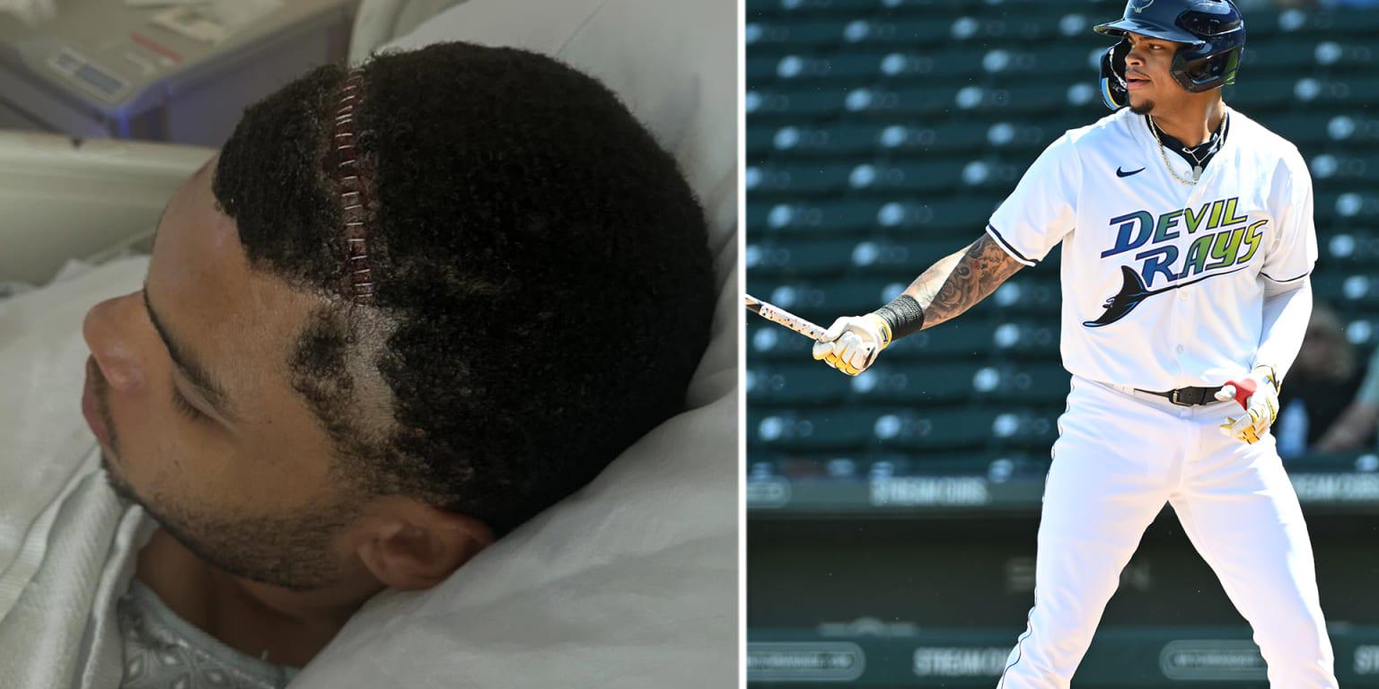 Rays prospect Isaac reveals 'life-saving' brain surgery