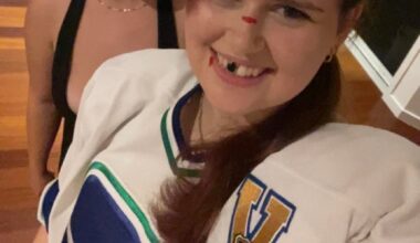 Injured Nucks player for Halloween