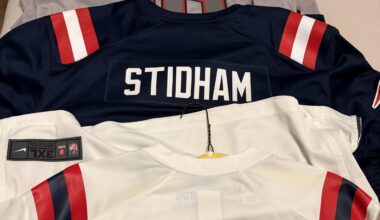 Bad, Ugly days also the ZAPPE Fever😂