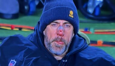 Aaron Rodgers looks like he tried to rob Kevin McCallister's house against the Bills. He is a defeated, punished old man.