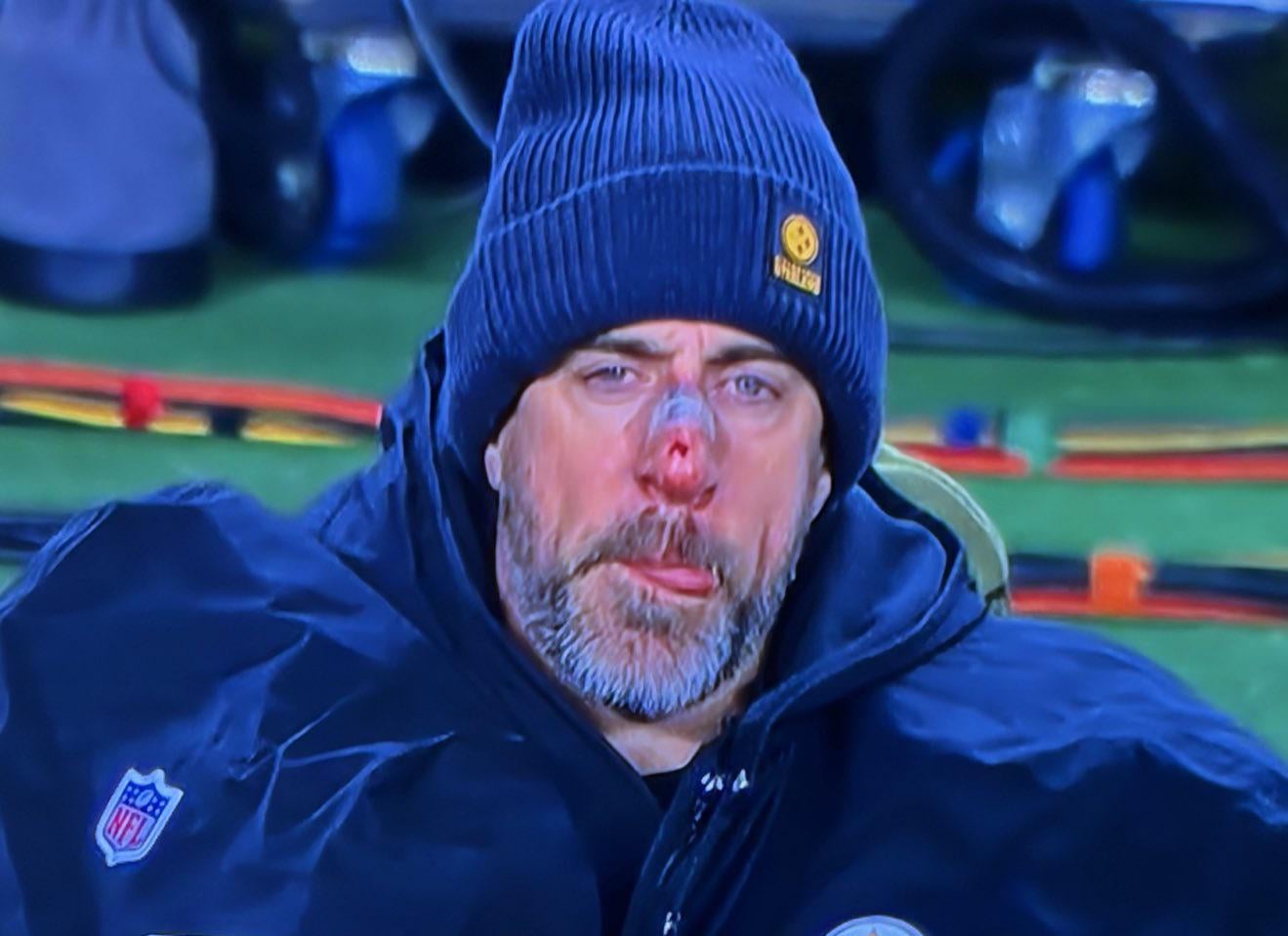 Aaron Rodgers looks like he tried to rob Kevin McCallister's house against the Bills. He is a defeated, punished old man.