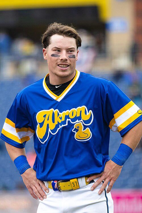 What’s your hopes for Bazzana? Potential upside comparisons?