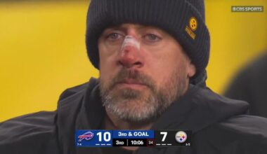 Aaron Rodgers looks like he tried to rob Kevin McCallister’s house. He is a punished old man.