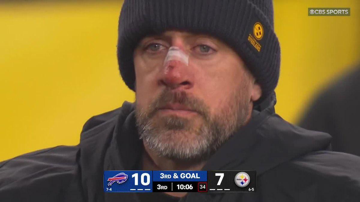 Aaron Rodgers looks like he tried to rob Kevin McCallister’s house. He is a punished old man.